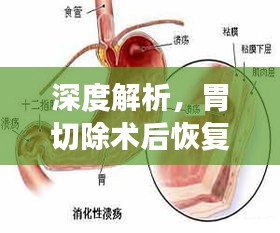 胃切除术后恢复期深度解析，预测以2024年观察点为中心的观察报告