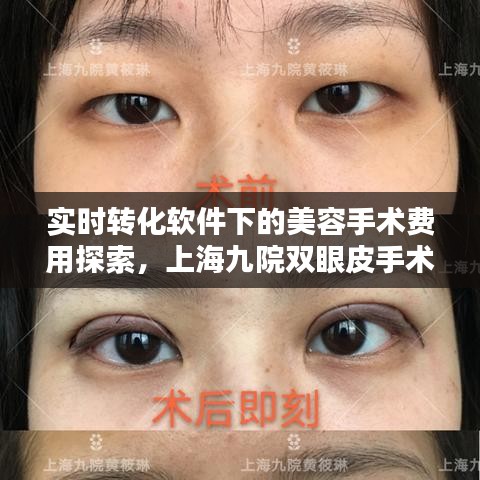 实时转化软件下的美容手术费用探索,上海九院双眼皮手术价格揭秘