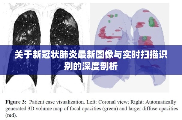 关于新冠状肺炎最新图像与实时扫描识别的深度剖析