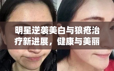 明星逆袭美白与狼疮治疗新进展，健康与美丽的双重追求
