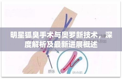 明星狐臭手术与奥罗新技术，深度解析及最新进展概述