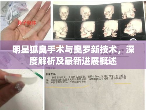 明星狐臭手术与奥罗新技术,深度解析及最新进展概述