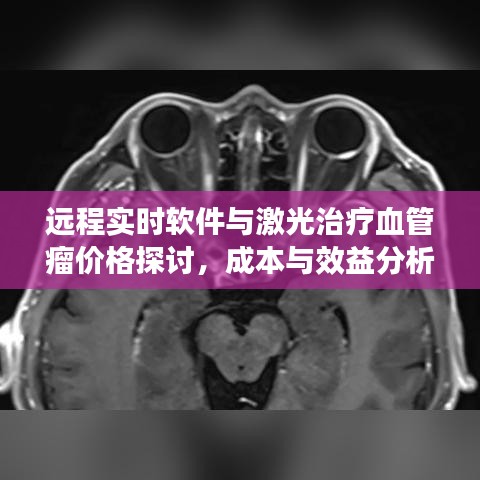 远程实时软件与激光治疗血管瘤价格探讨，成本与效益分析